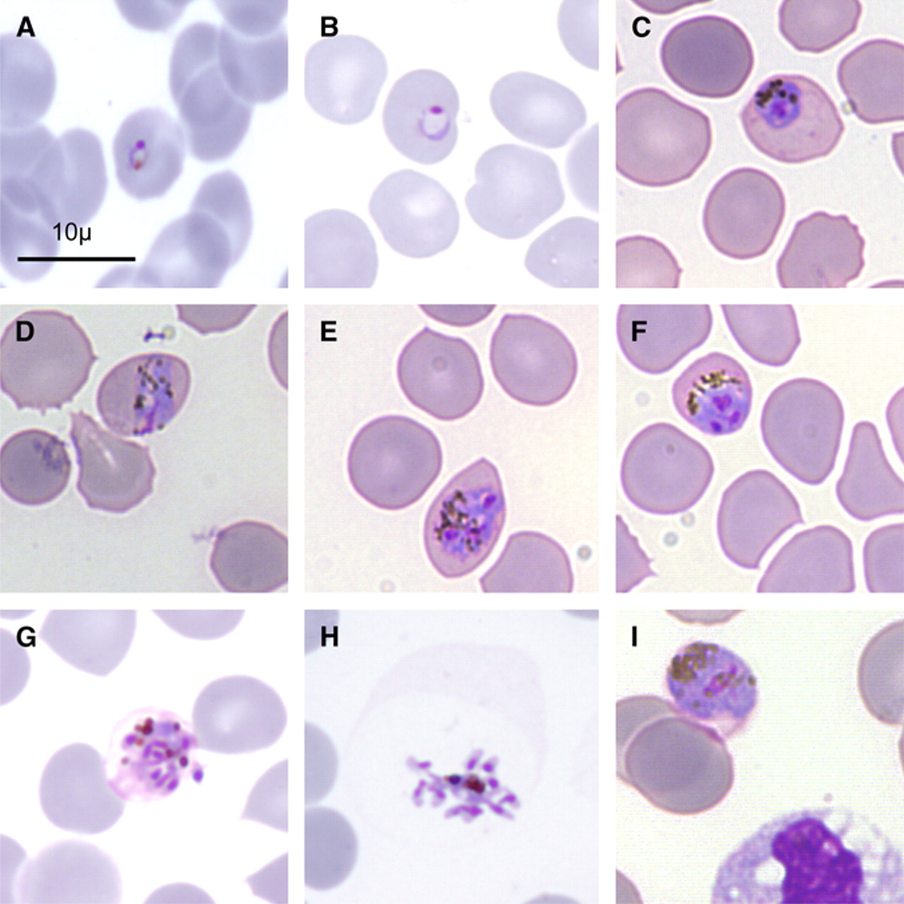 Plasmodium knowlesi