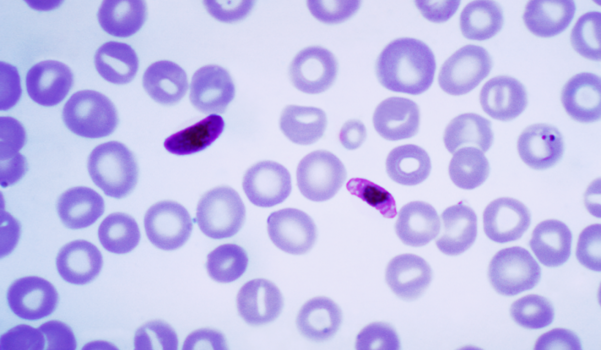 malária plazmodium)