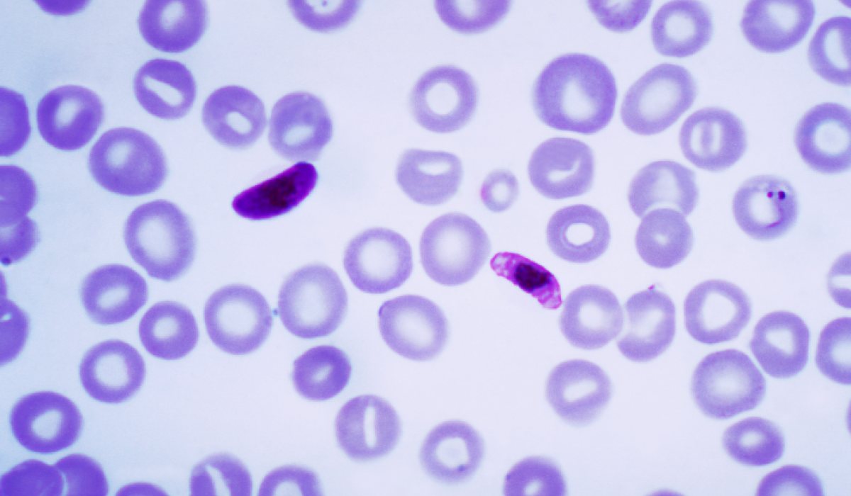 plasmodium-falciparum-scientists-against-malaria