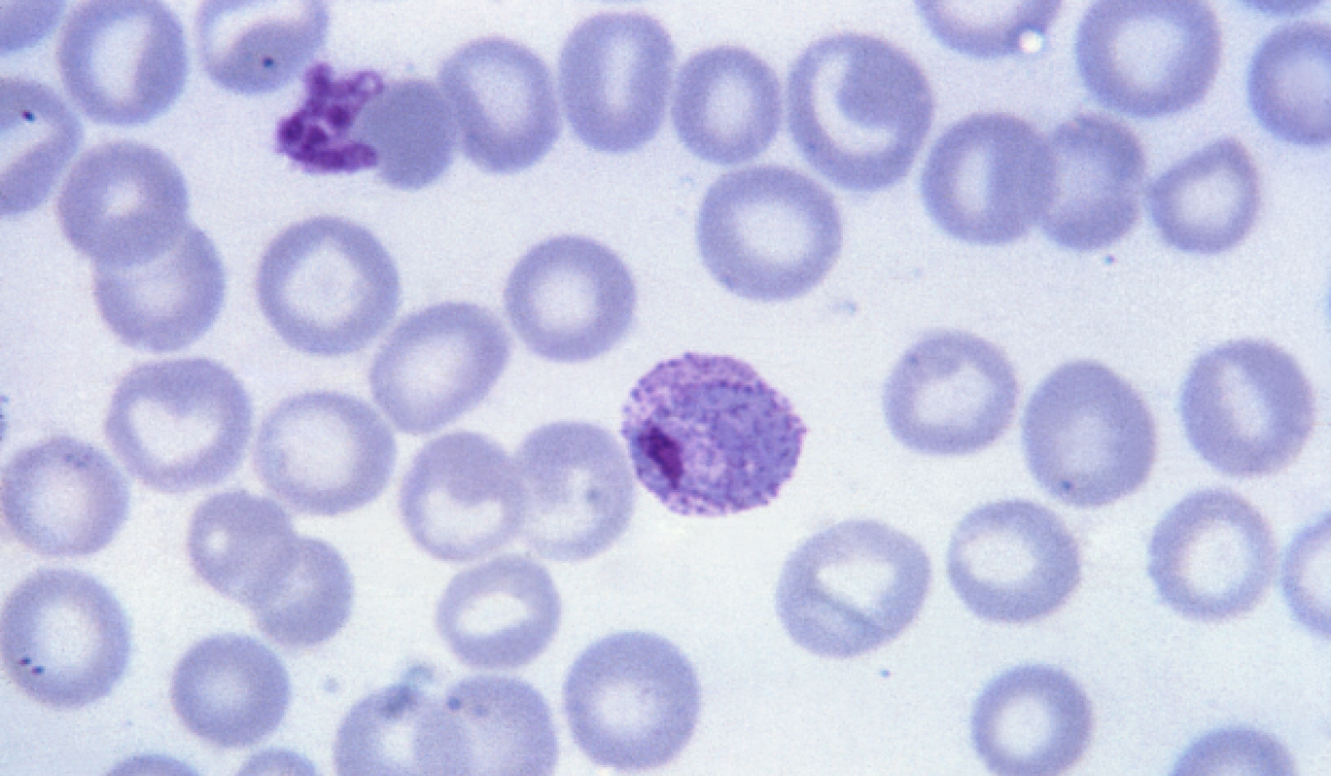 plazmodikus malária)