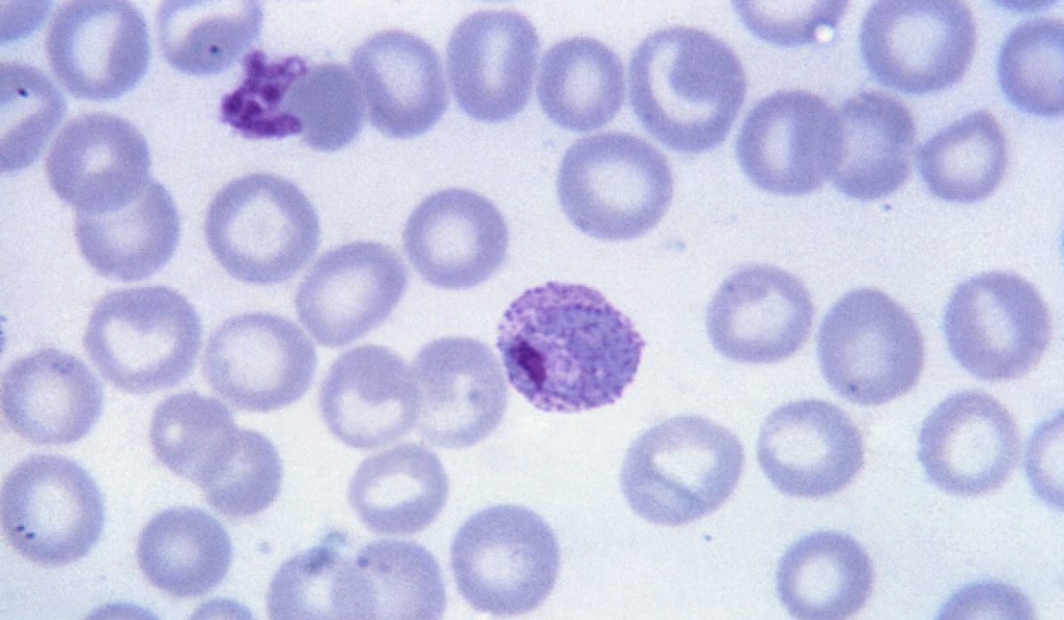 malaria parasite