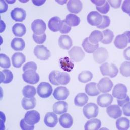Plasmodium malariae, malaria parasite