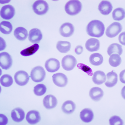 Plasmodium falciparum, malaria parasite