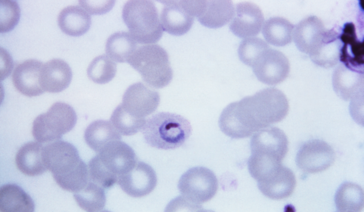 Plasmodium ovale, malaria parasite