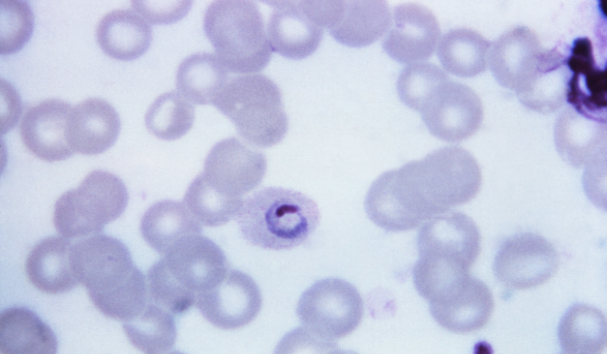 Plasmodium ovale | Scientists Against Malaria