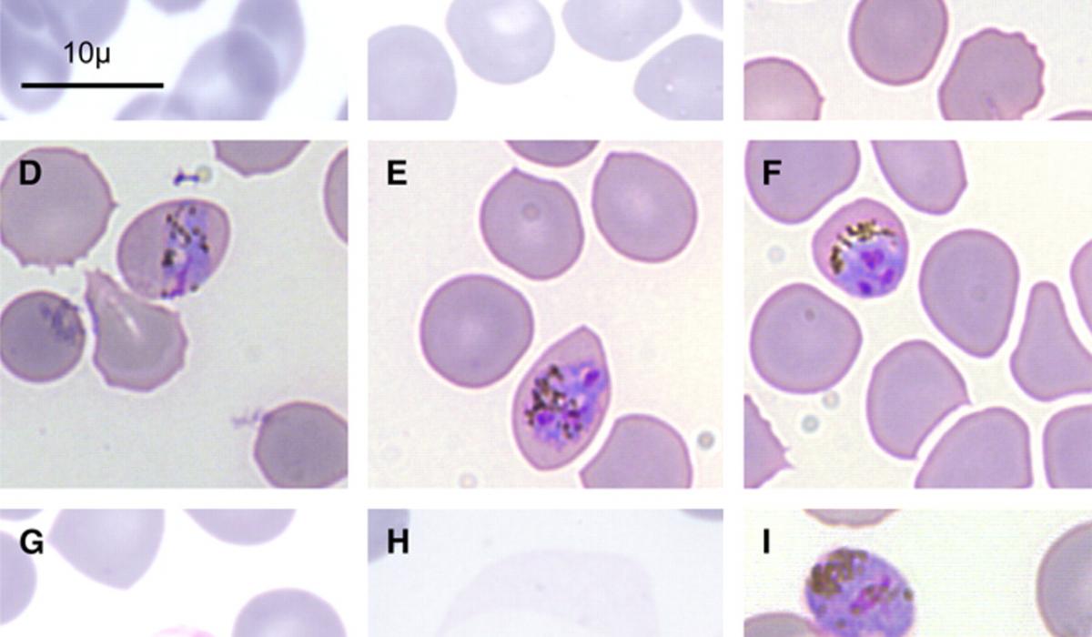 Plasmodium knowlesi, malaria parasite